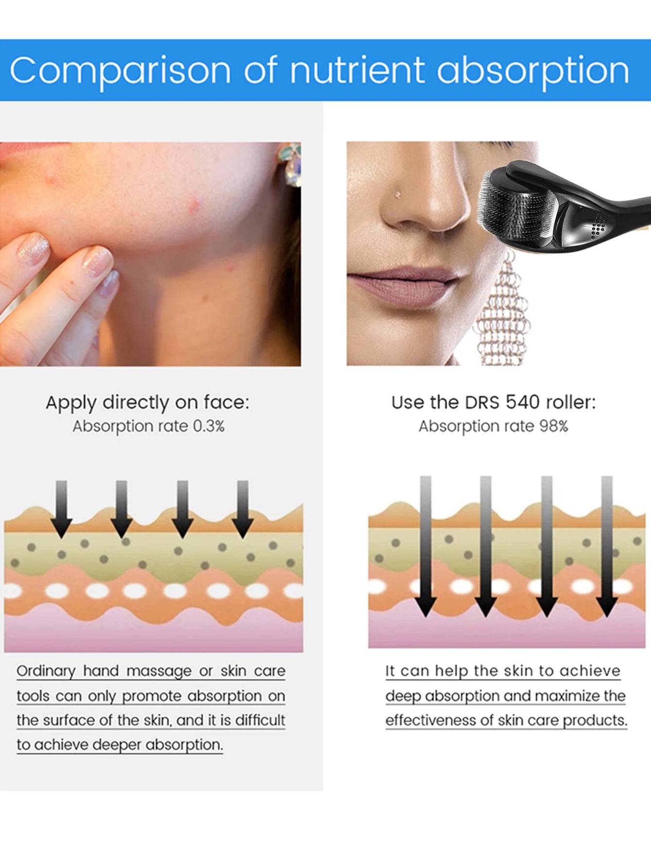 1 Pcs 540 Microneedle Rollers Dermatological Derma Micro Needles Titanium Help Hair Softens Acne Scars Skin Face Care Tool